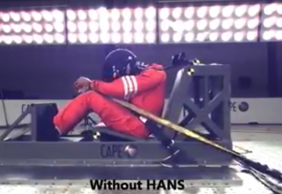 This is why you should always use a HANS device on a race track